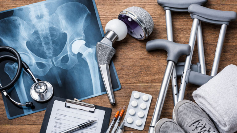 Kalça Protezi Ameliyatı Nedir, Nasıl Yapılır?